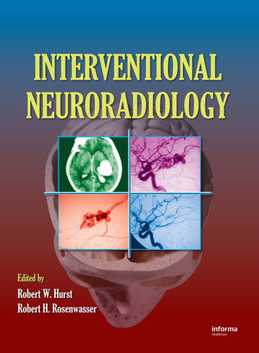 Interventional Neuroradiology