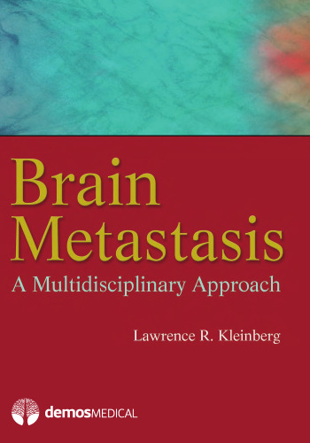 Brain Metastasis: A Multidisciplinary Approach