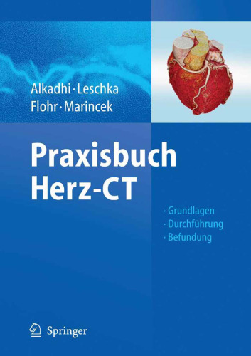 Praxisbuch Herz-CT: Grundlagen - Durchführung - Befundung (German Edition)