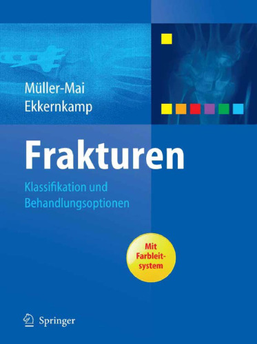 Frakturen: Klassifikation und Behandlungsoptionen