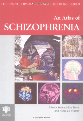 An Atlas of Schizophrenia