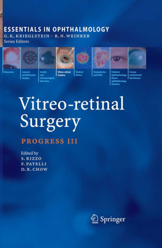 Vitreo-retinal Surgery: Progress III (Essentials in Ophthalmology)