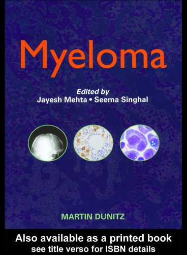 Myeloma