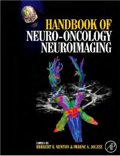 Handbook of Neuro-Oncology Neuro-Imaging