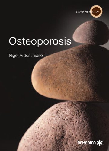 Osteoporosis (Illustrated)