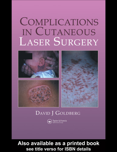 Complications in Laser Cutaneous Surgery