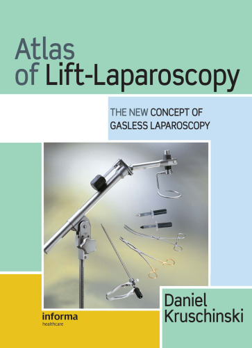 Atlas of Lift-Laparoscopy: The New Concept of Gasless Laparoscopy (Encyclopedia of Visual Medicine Series)