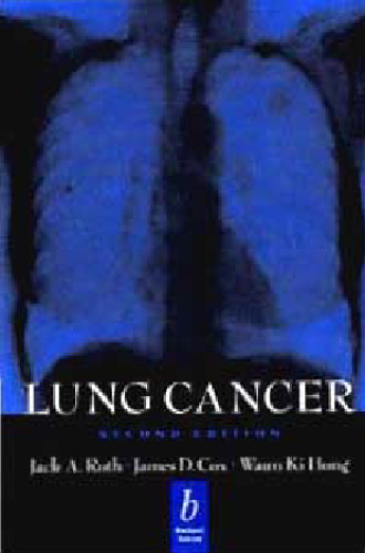 Lung Cancer  Second edition