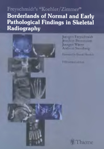 Koehler Zimmer's Borderlands of Normal and Early Pathological Findings in Skeletal Radiography  5th Edition