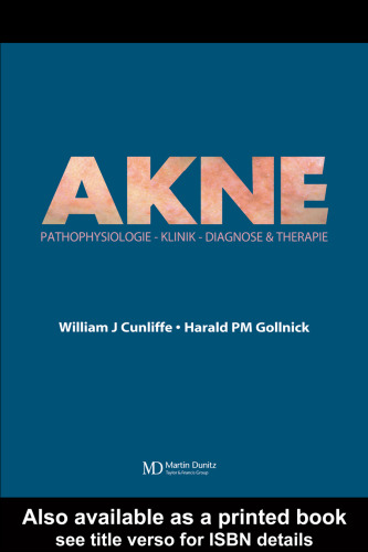 Akne - Pathophysiologie, Klinik, Diagnosis & Therapie