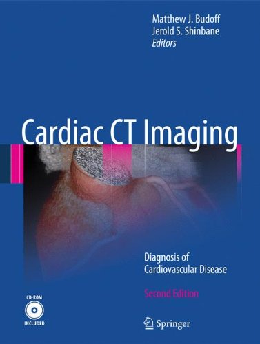 Cardiac CT Imaging: Diagnosis of Cardiovascular Disease