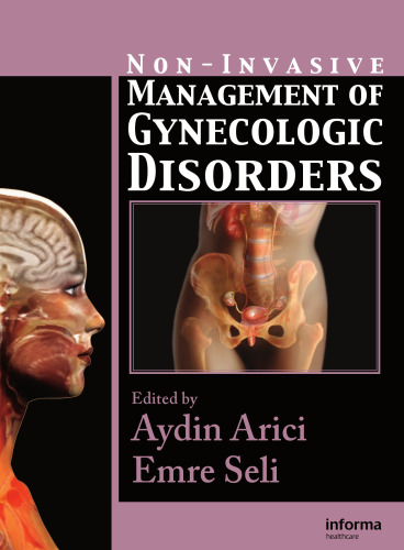 Non-Invasive Management of Gynecologic Disorders