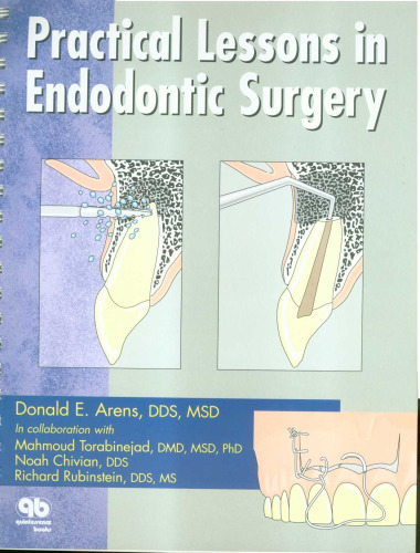 Practical Lessons in Endodontic Surgery