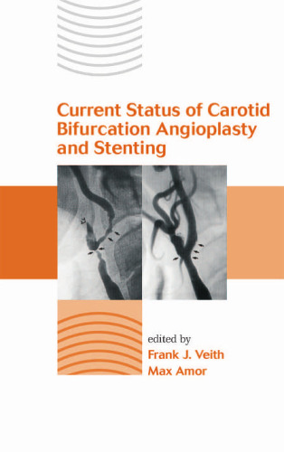 Current Status of Carotid Bifurcation Angioplasty and Stenting