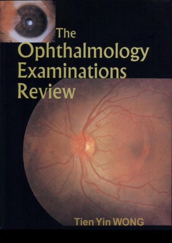 The Ophthalmology Examinations Review