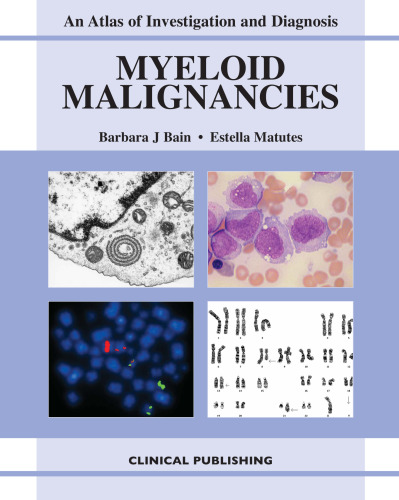 Myeloid Malignancies: An Atlas of Investigation and Diagnosis