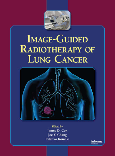 Image-Guided Radiotherapy of Lung Cancer