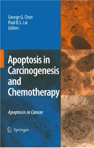 Apoptosis in Carcinogenesis and Chemotherapy: Apoptosis in cancer