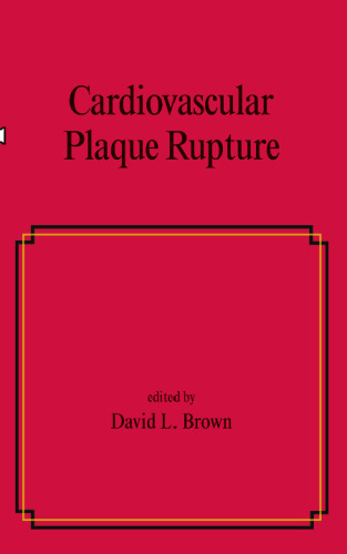 Cardiovascular Plaque Rupture (Fundamental and Clinical Cardiology, 45)