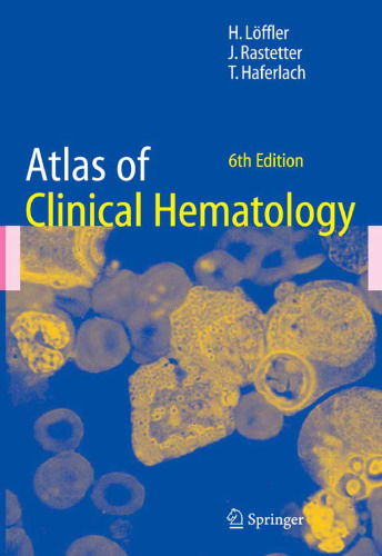 Atlas of Clinical Hematology 6th Edition