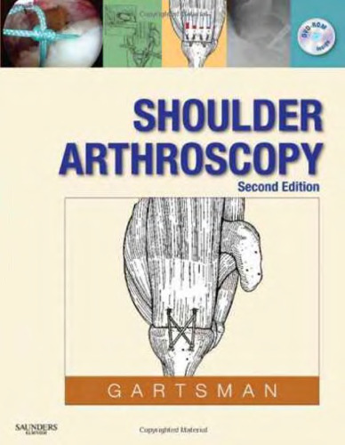 Shoulder Arthroscopy, 2nd Edition