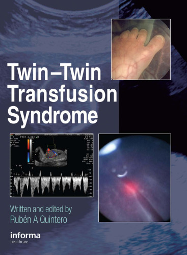 Twin-Twin Transfusion Syndrome