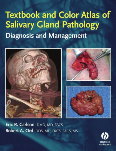 Textbook and Color Atlas of Salivary Gland Pathology: Diagnosis and Management