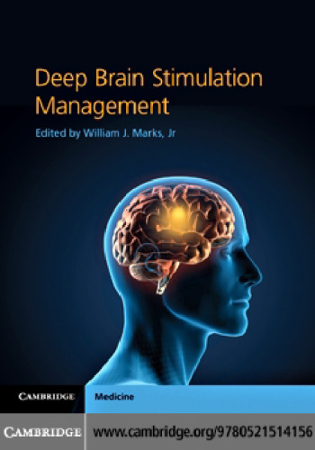 Deep Brain Stimulation Management