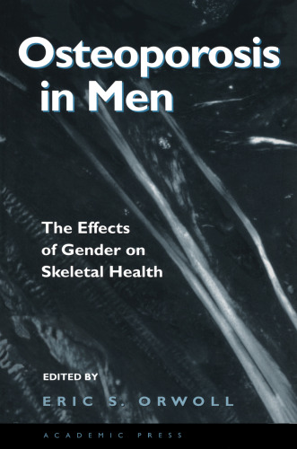 Osteoporosis in Men: The Effects of Gender on Skeletal Health