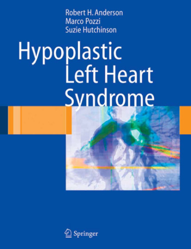 Hypoplastic Left Heart Syndrome