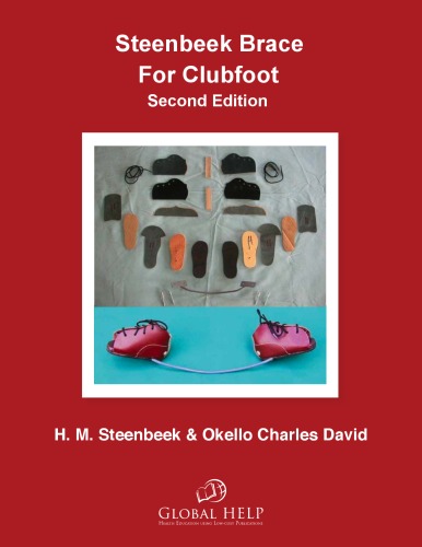 Steenbeek Brace For Clubfoot, 2nd Edition