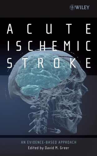 Acute Ischemic Stroke: An Evidence-based Approach