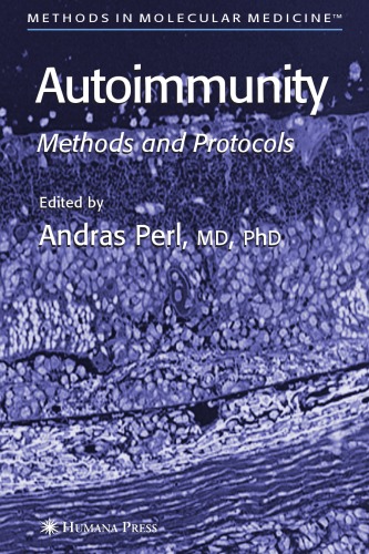 Autoimmunity: Methods and Protocols