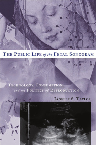 The Public Life of the Fetal Sonogram: Technology, Consumption, and the Politics of Reproduction