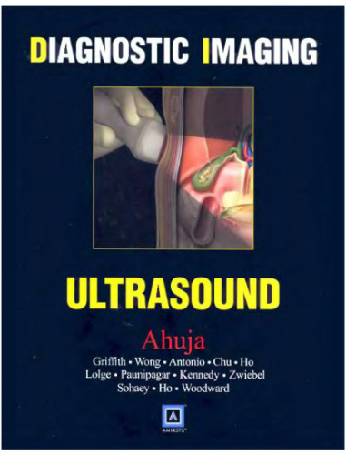 Diagnostic Imaging: Ultrasound