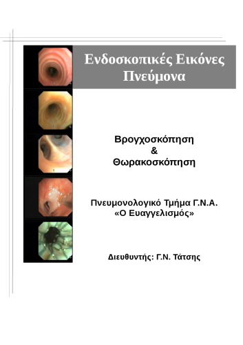 Ενδοσκοπικές Εικόνες Πνεύμονα Βρογχοσκόπηση & Θωρακοσκόπηση