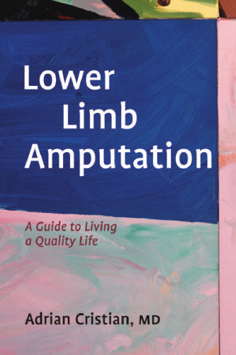 Lower Limb Amputation: A Guide to Living a Quality Life