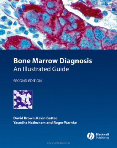 Bone Marrow Diagnosis: An Illustrated Guide 2nd Edition