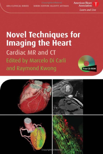 Novel Techniques for Imaging the Heart: Cardiac MR and CT (American Heart Association Clinical Series)