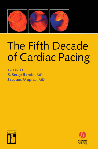 The fifth decade of cardiac pacing