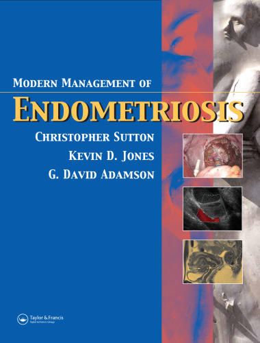 Modern Management of Endometriosis