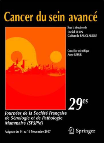 Cancer du sein avancé: 29es Journées de la Société Française de Sénologie et Pathologie Mammaire (SFSPM)