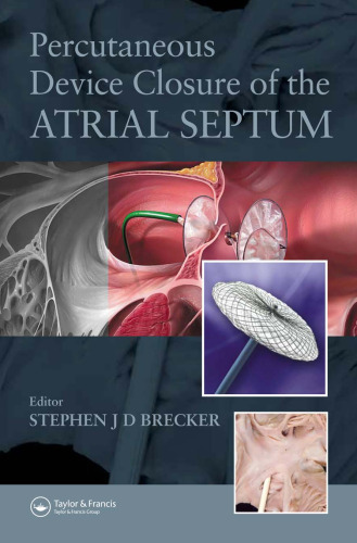 Percutaneous Device Closure of the Atrial Septum