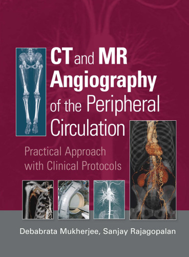 CT and MR Angiography of the Peripheral Circulation: Practical Approach with Clinical Protocols