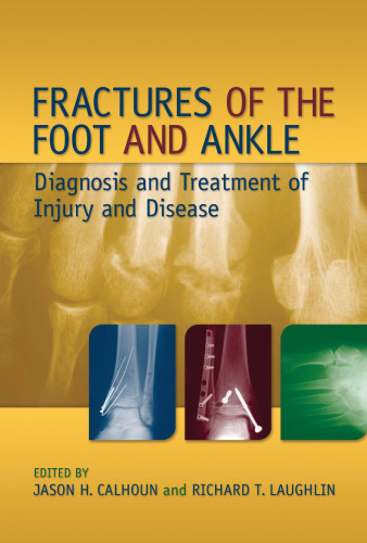 Fractures of the Foot and Ankle: Diagnosis and Treatment of Injury and Disease