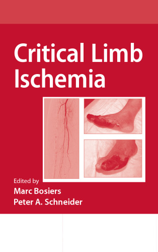 Critical Limb Ischemia