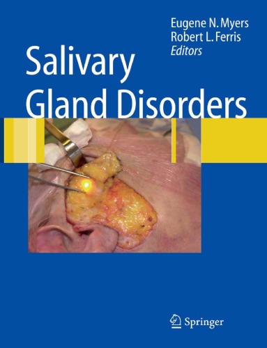 Salivary Gland Disorders