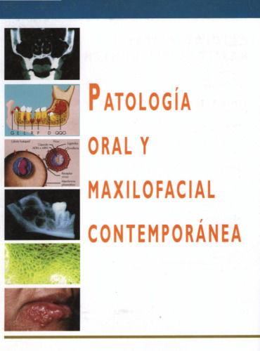 Patologia Oral y Maxilofacial Contemporanea