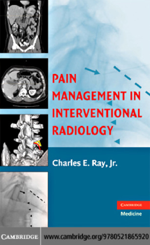 Pain Management in Interventional Radiology