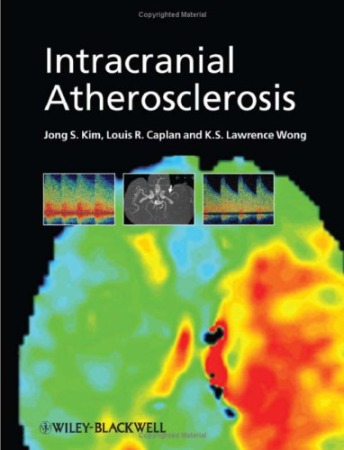 Intracranial Atherosclerosis